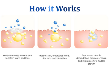 Fivfivgo™ WartsOff Instant Blemish Removal Cream - PREMIUM