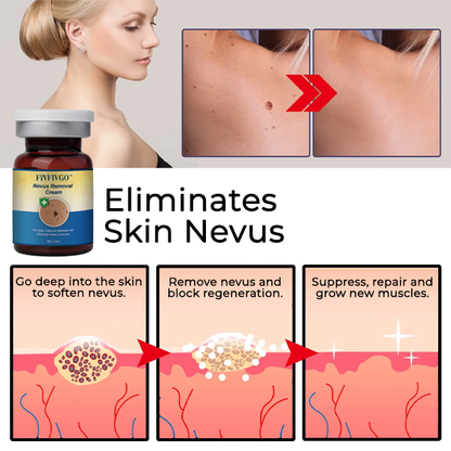 Fivfivgo™ Nevus Removal Cream