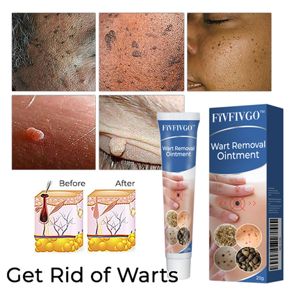 Fivfivgo™ Wart Removal Ointment