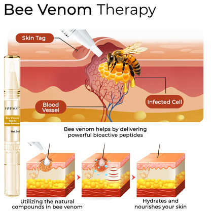 Fivfivgo™ Bee Venom Tags & Moles Remover