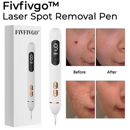 Fivfivgo™ Laser Spot Removal Pen