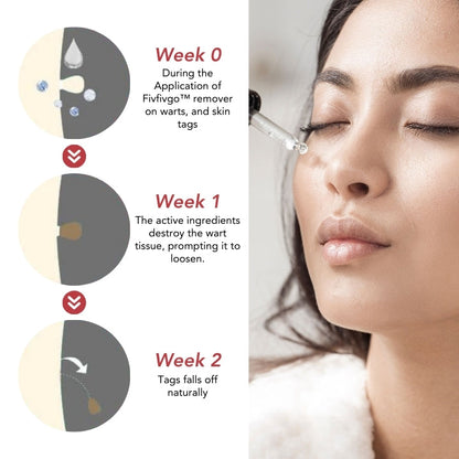 Fivfivgo™ SkinClear Tags & Mole Remover