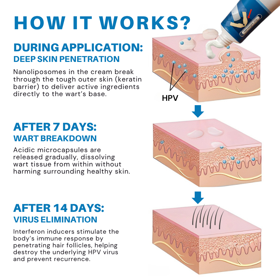 Fivfivgo® HPV Genital Warts Relief Cream 18 Fivfivgo® HPV Genital Warts Relief Cream