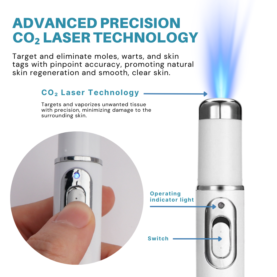 Bikenda® Non-Invasive Mole and Wart Removal Laser Pen 22 Bikenda® Non-Invasive Mole and Wart Removal Laser Pen