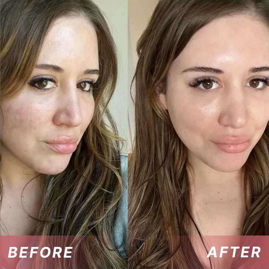 Fivfivgo® Tags & Blemish Peel-Off Wrapping Mask