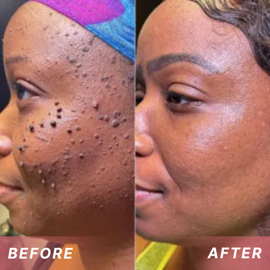 Fivfivgo® Tags & Blemish Peel-Off Wrapping Mask