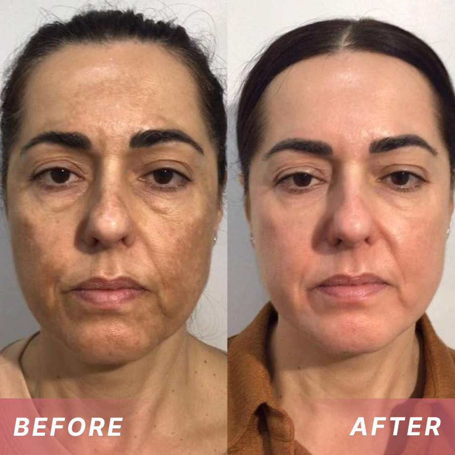 Fivfivgo® Tags & Blemish Peel-Off Wrapping Mask