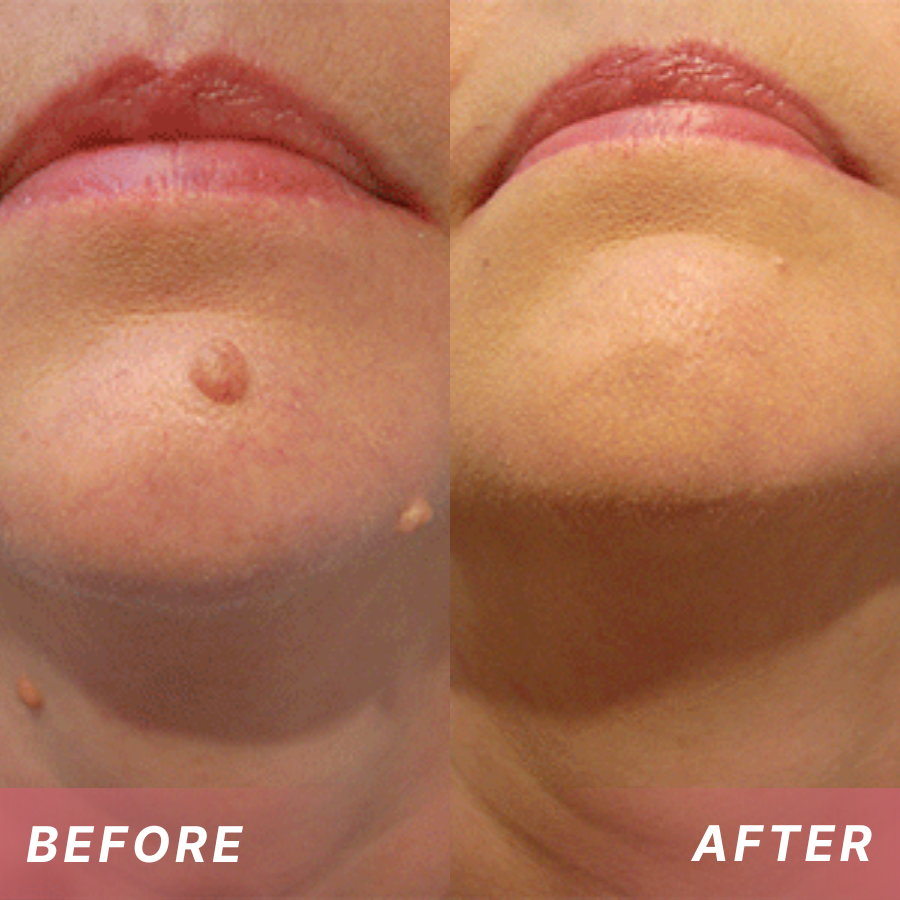 Fivfivgo® Tags & Blemish Peel-Off Wrapping Mask